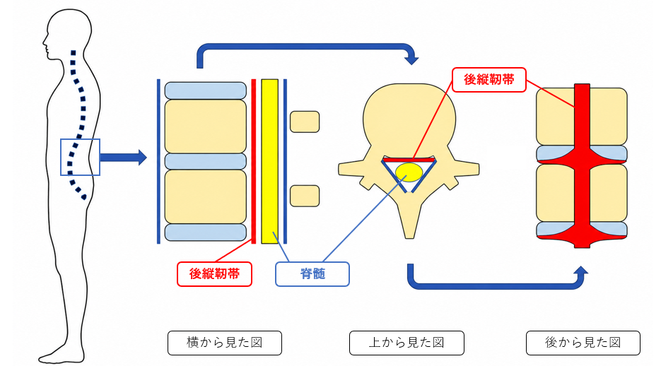 後縦靭帯と脊髄の位置、横から見た図、上から見た図、後ろから見た図